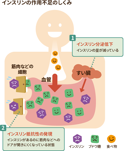[図] インスリンの作用不足のしくみ 1:インスリン分泌低下 インスリンの量が減っている　2.インスリン抵抗性の発現 インスリンがあるのに筋肉などへのドアが開きにくくなっている状態